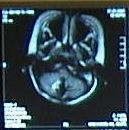 MRI02.07.22
